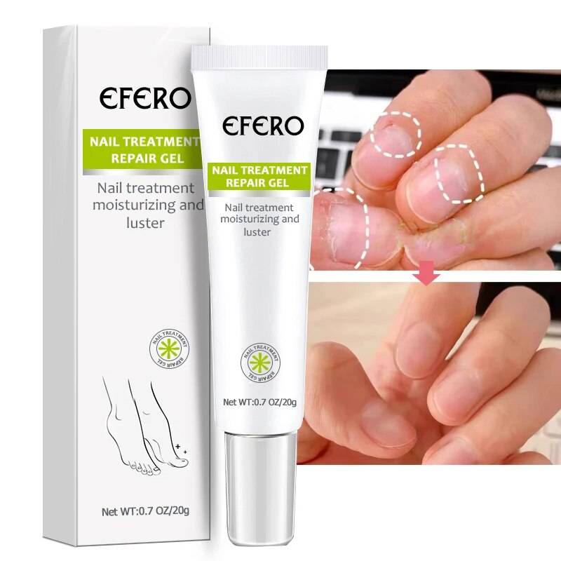 1/2/3/5pcs Nail Repair Essence Nourishing Brighten Foot Finger Care Nail Serum Nail Treatment Cream Women Men Nails Products
