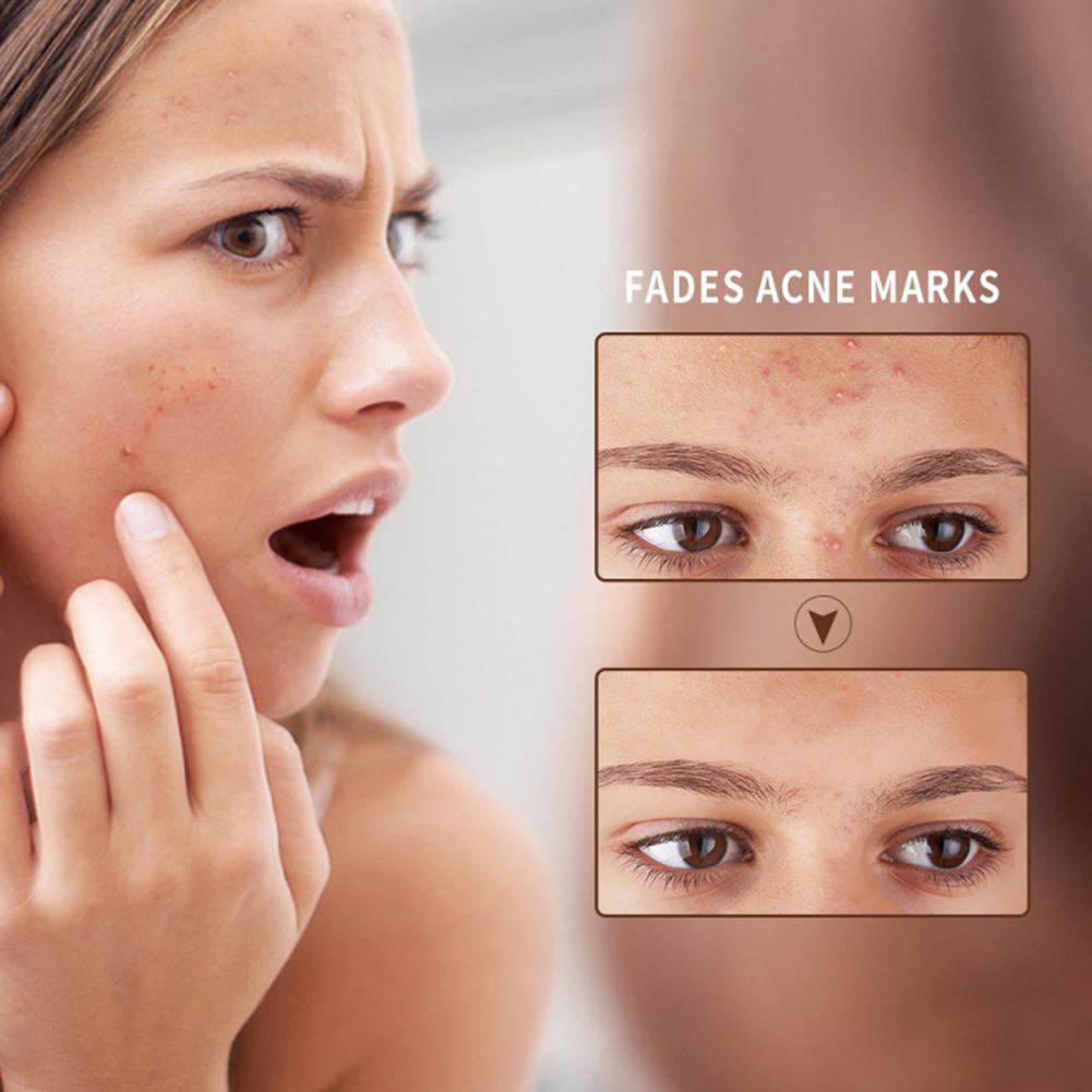 Aloe Hydrating Soothing Skin Care Gel
