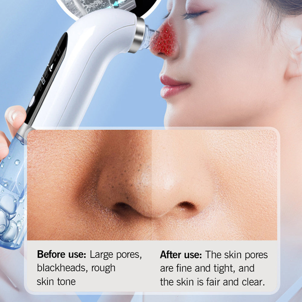Electric Small Bubble Blackhead Remover