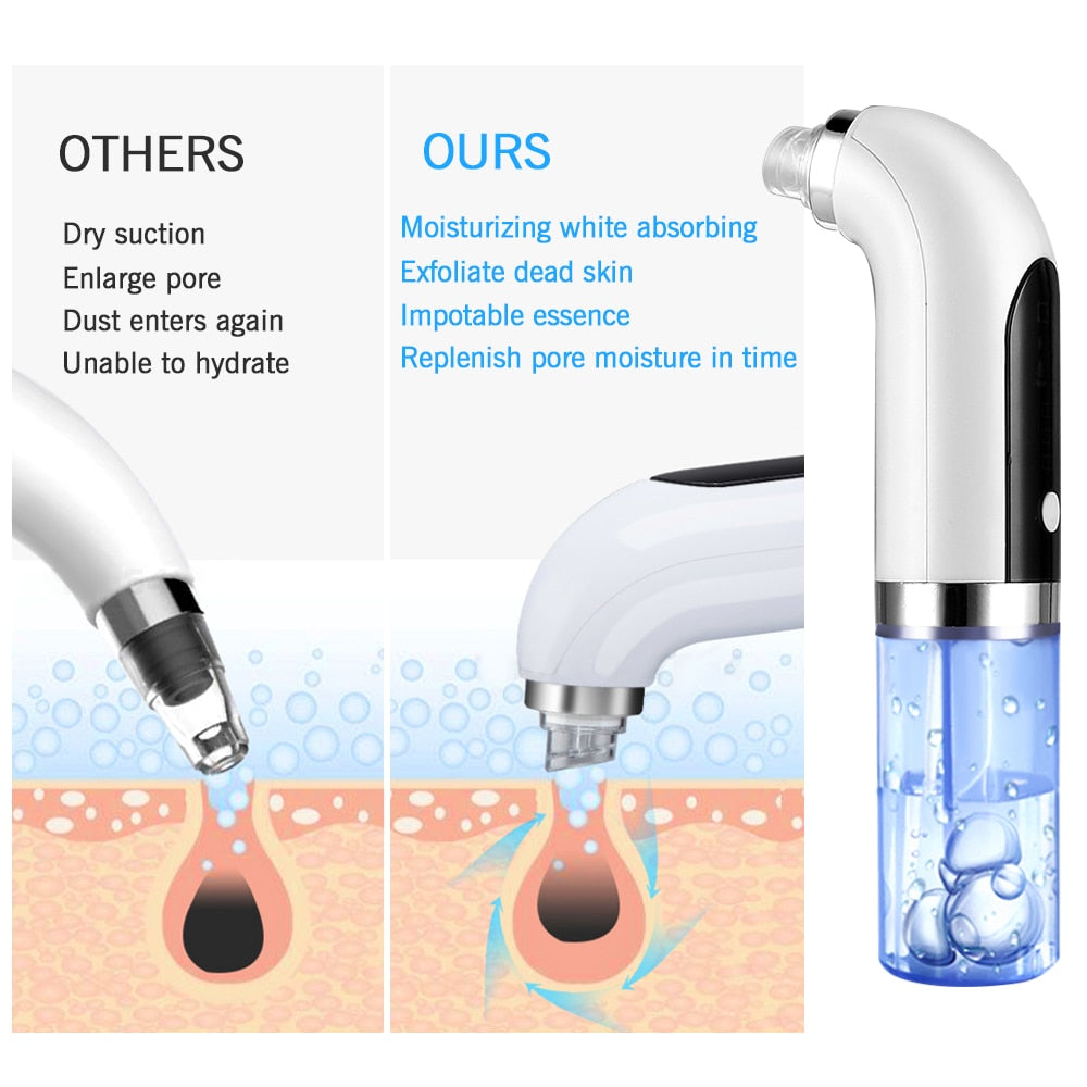 Electric Small Bubble Blackhead Remover